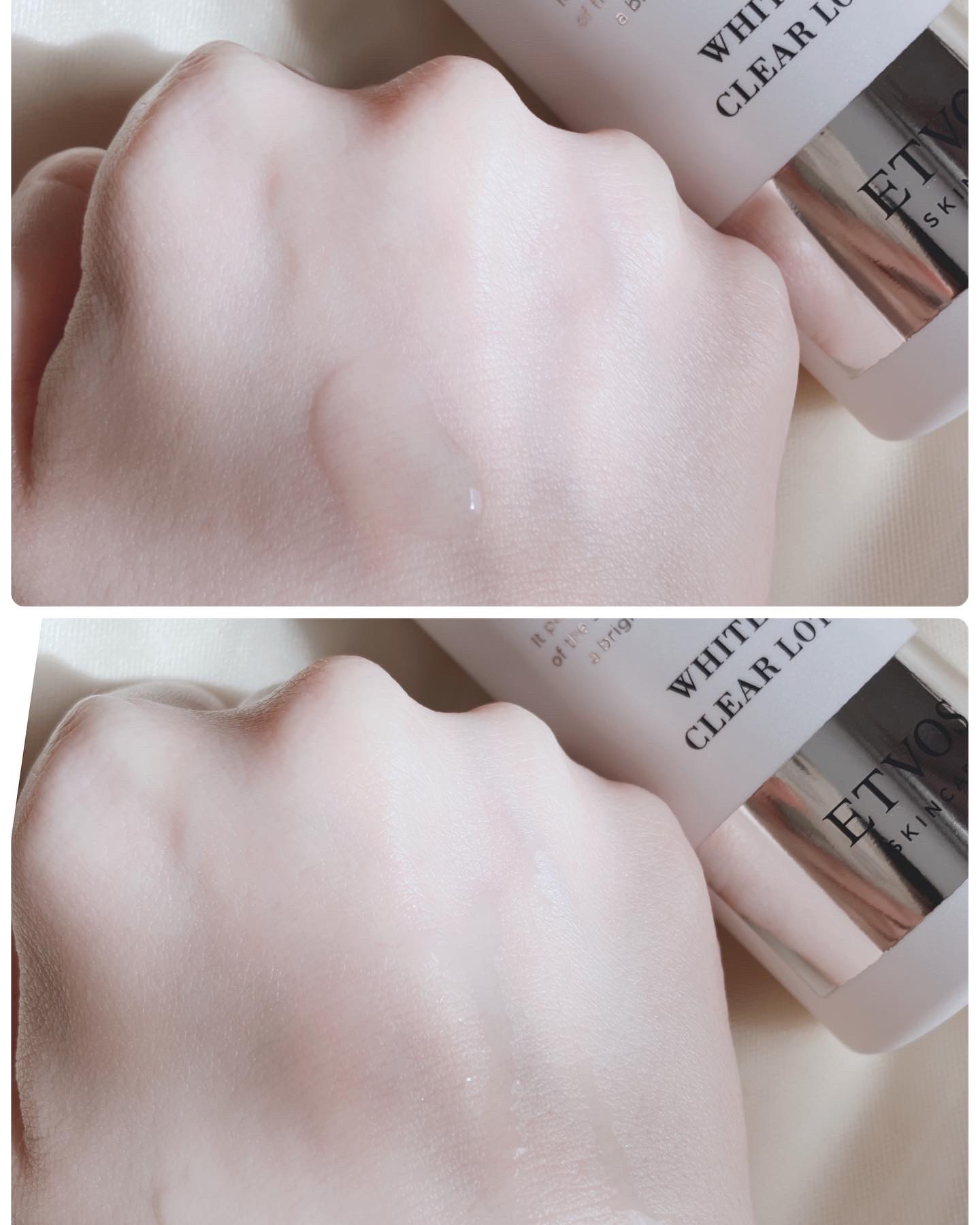 薬用 ホワイトニングクリアローション/エトヴォス/化粧水を使ったクチコミ（3枚目）
