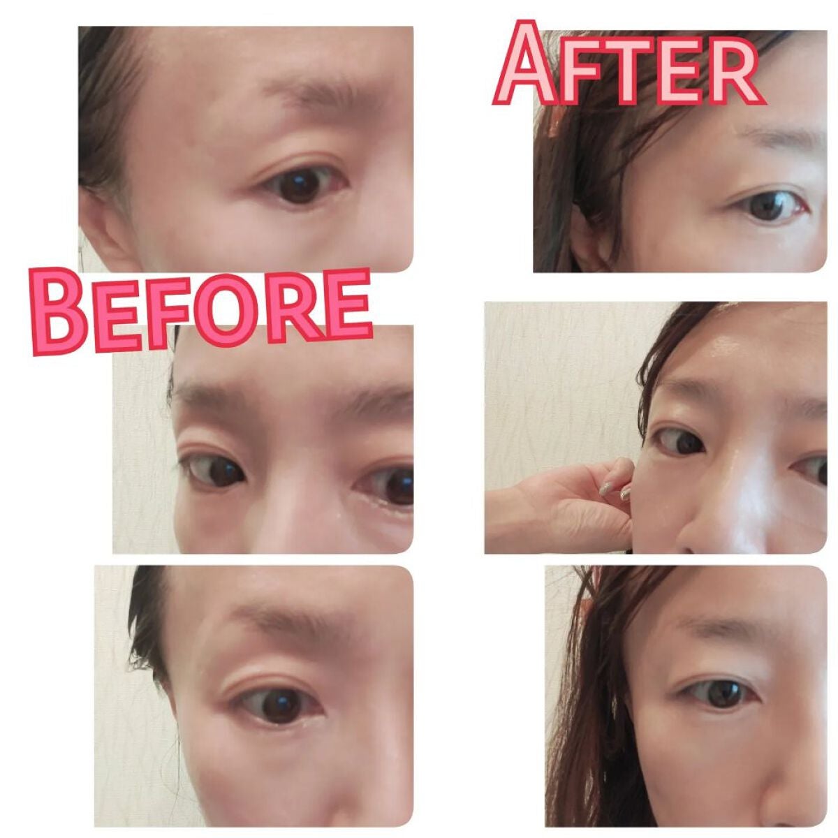 ヒアロディープパッチ/北の快適工房/シートマスク・パックを使ったクチコミ(2枚目)