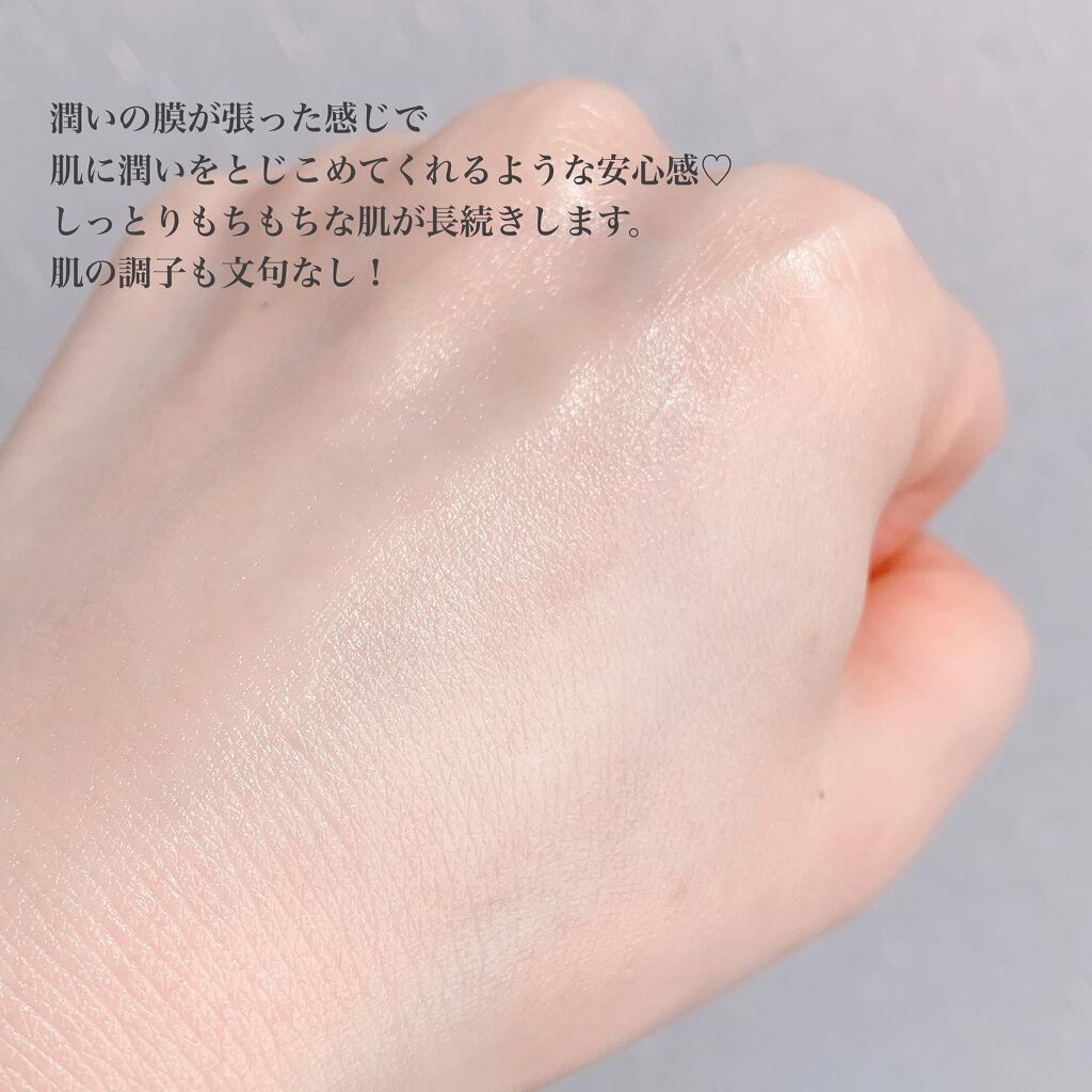 ドクダミ 70 インテンスカーミングクリーム/Anua/フェイスクリームを使ったクチコミ(4枚目)