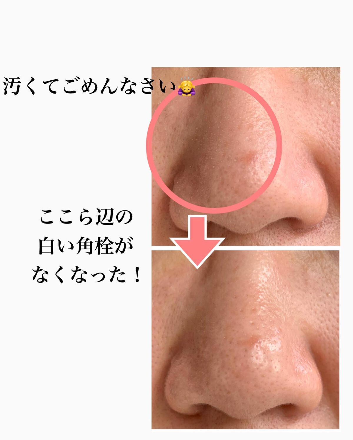 ãã¿ããðæçš¿ããæ¹ãã©ããã on LIPS ãQ10ã®ã¡ã¬å²ã§èŠã€ããŠæãããã±è²·ããããã¡ããããŒã¢ã¢ãã©..ãïŒ4æç®ïŒ