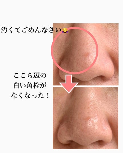 ãã¿ããðæçš¿ããæ¹ãã©ããã on LIPS ãQ10ã®ã¡ã¬å²ã§èŠã€ããŠæãããã±è²·ããããã¡ããããŒã¢ã¢ãã©..ãïŒ4æç®ïŒ