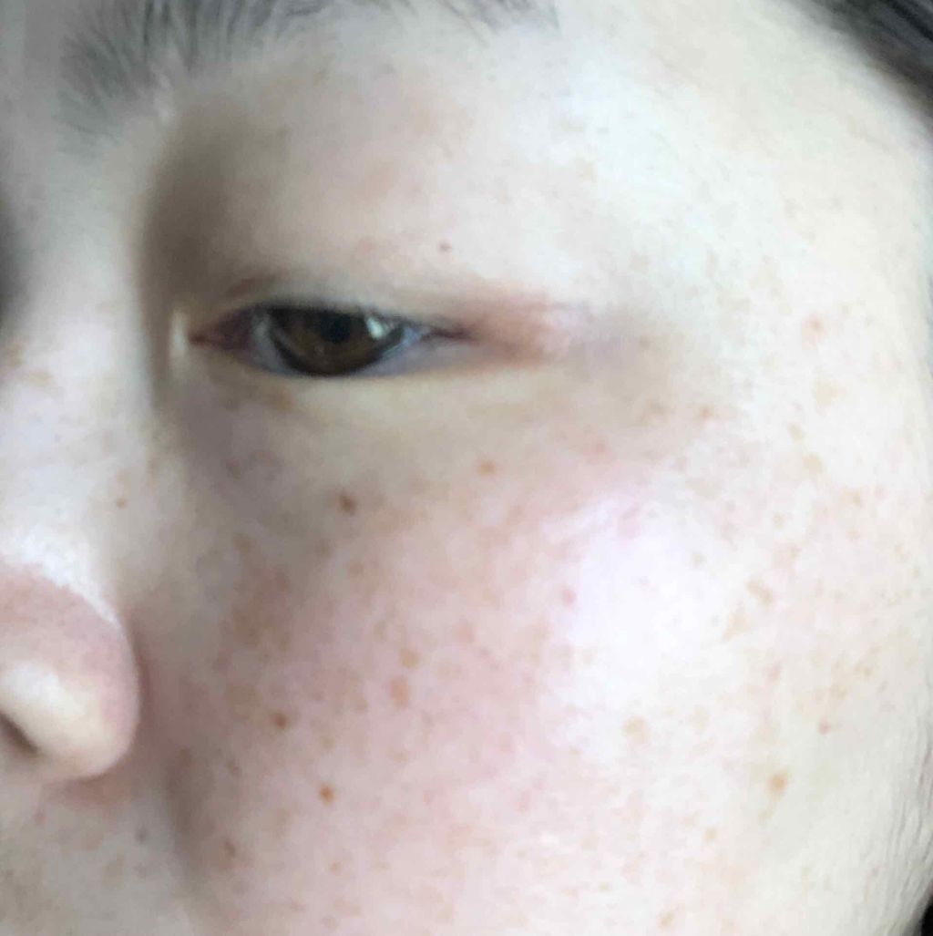 エマルジョン I/BENEFIQUE/乳液を使ったクチコミ(1枚目)