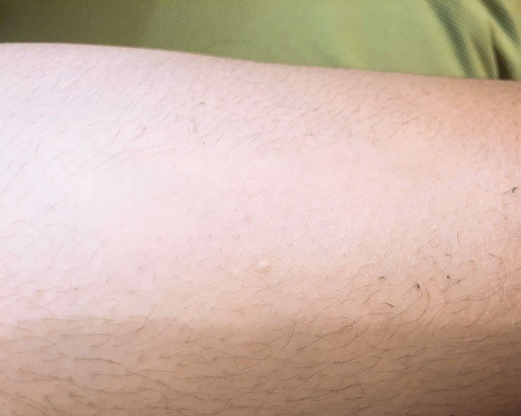 スムーズスキン/DAISO/ムダ毛ケアを使ったクチコミ（1枚目）