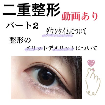 二重整形/その他を使ったクチコミ(1枚目)