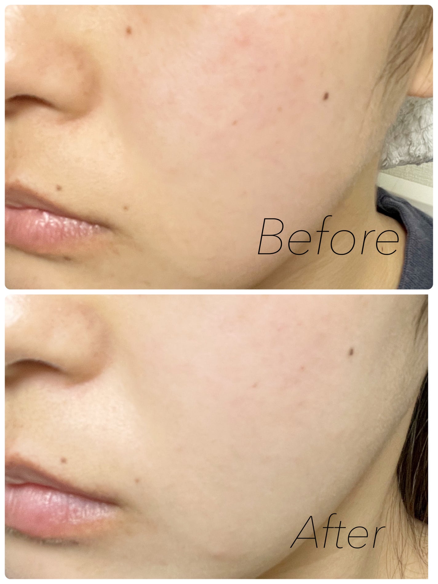 角質スッキリ毛穴パック /HANYUL(ハンユル)/洗い流すパック・マスクを使ったクチコミ(3枚目)