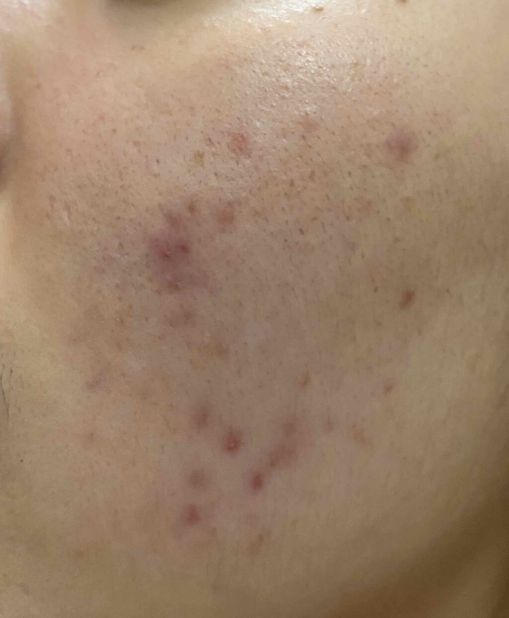 Cセラム/b.glen/美容液を使ったクチコミ（3枚目）