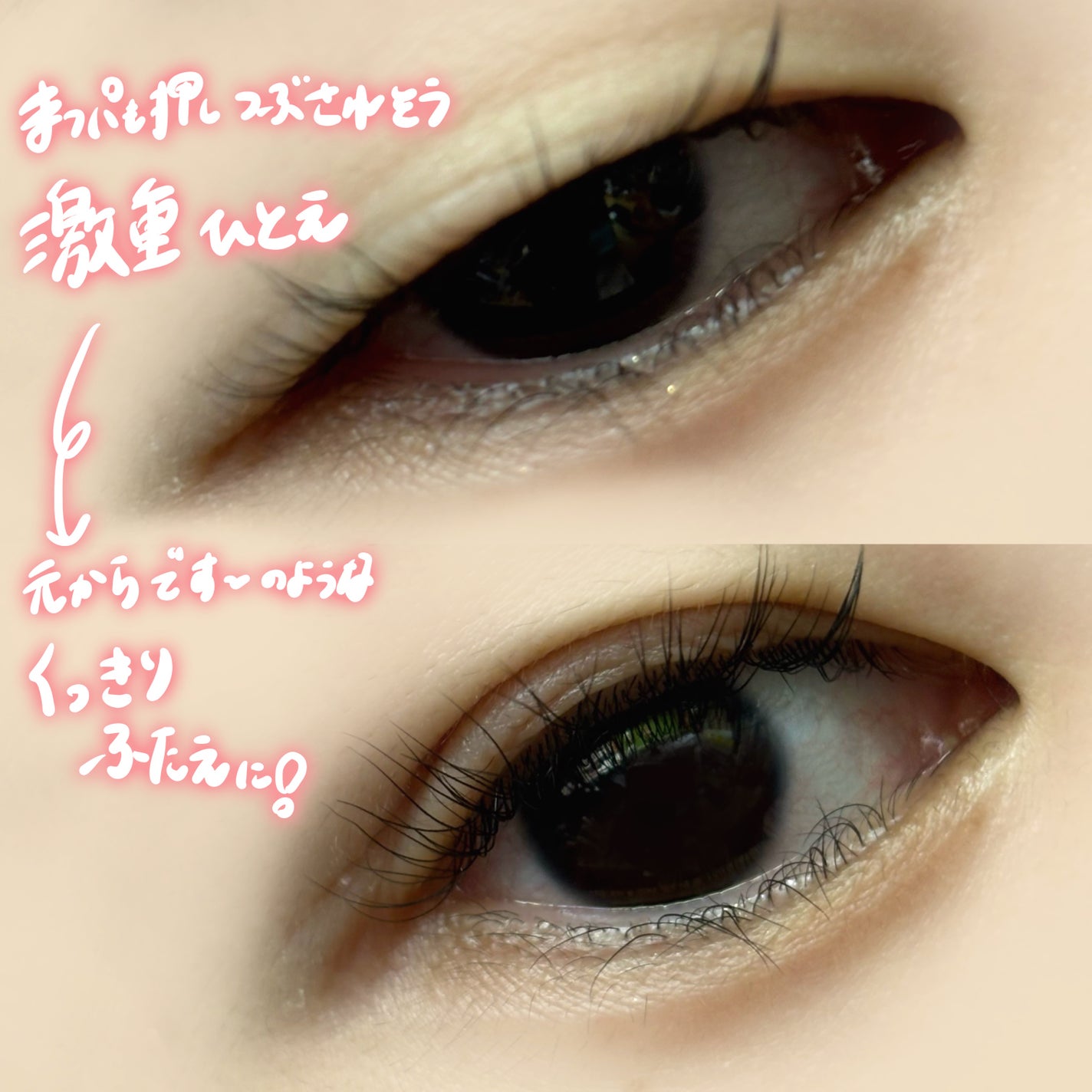 メザイク クリップ カッター ファイバー専用カッター/メザイク/二重まぶた用アイテムを使ったクチコミ(4枚目)