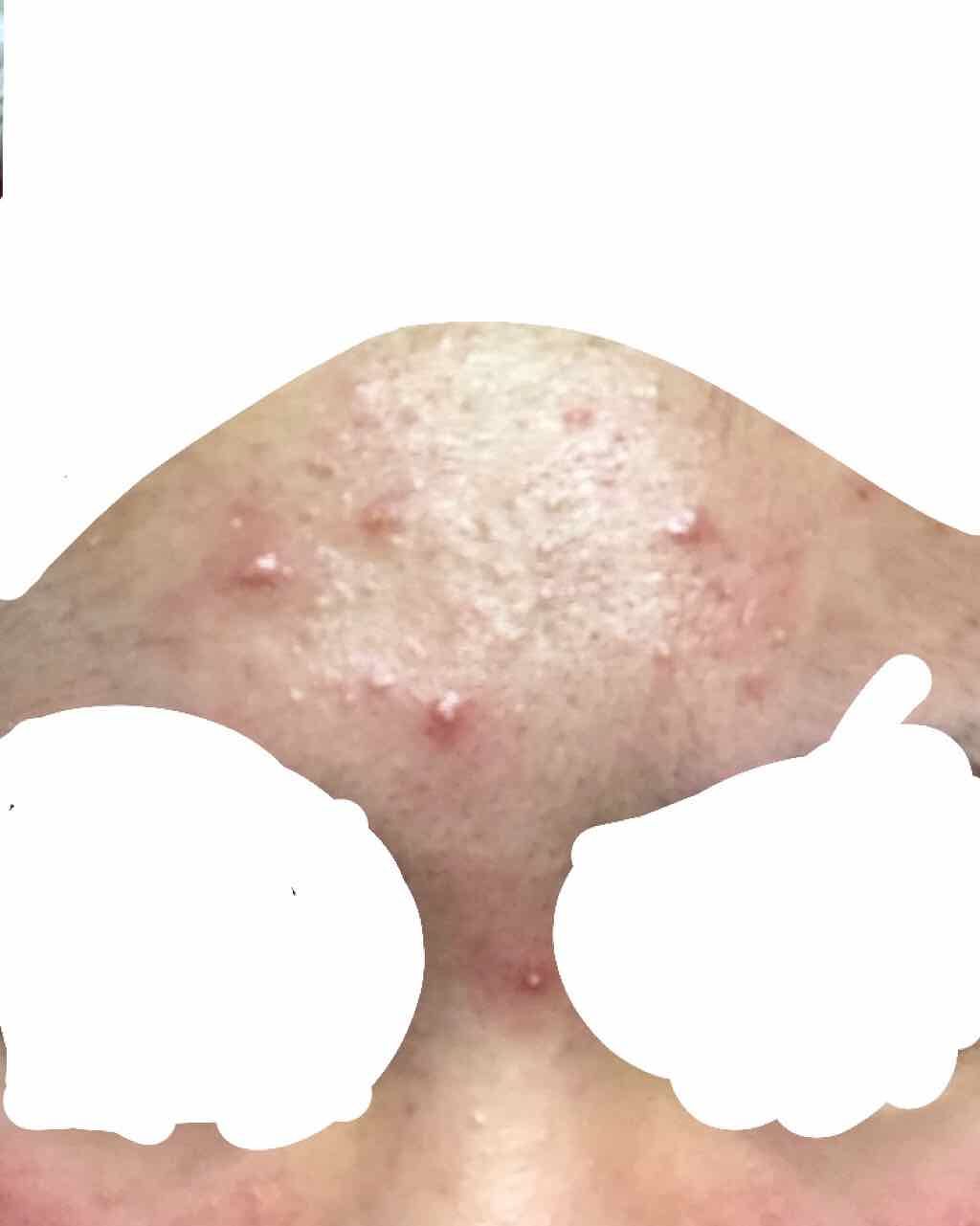 精製水(医薬品)/健栄製薬/その他を使ったクチコミ(2枚目)