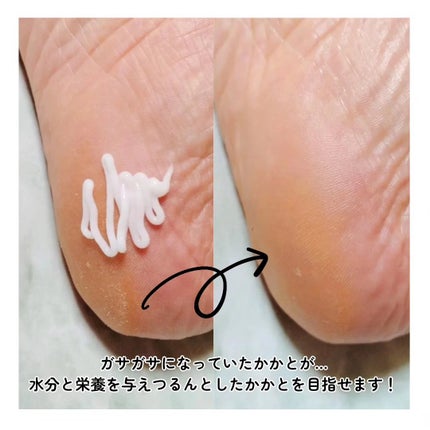 ケラサル ネイル爪栄養剤/Kerasal/ネイルオイル・トリートメントを使ったクチコミ(6枚目)