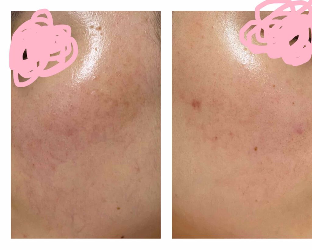 アルビオン 薬用スキンコンディショナー エッセンシャル/ALBION/化粧水を使ったクチコミ（3枚目）