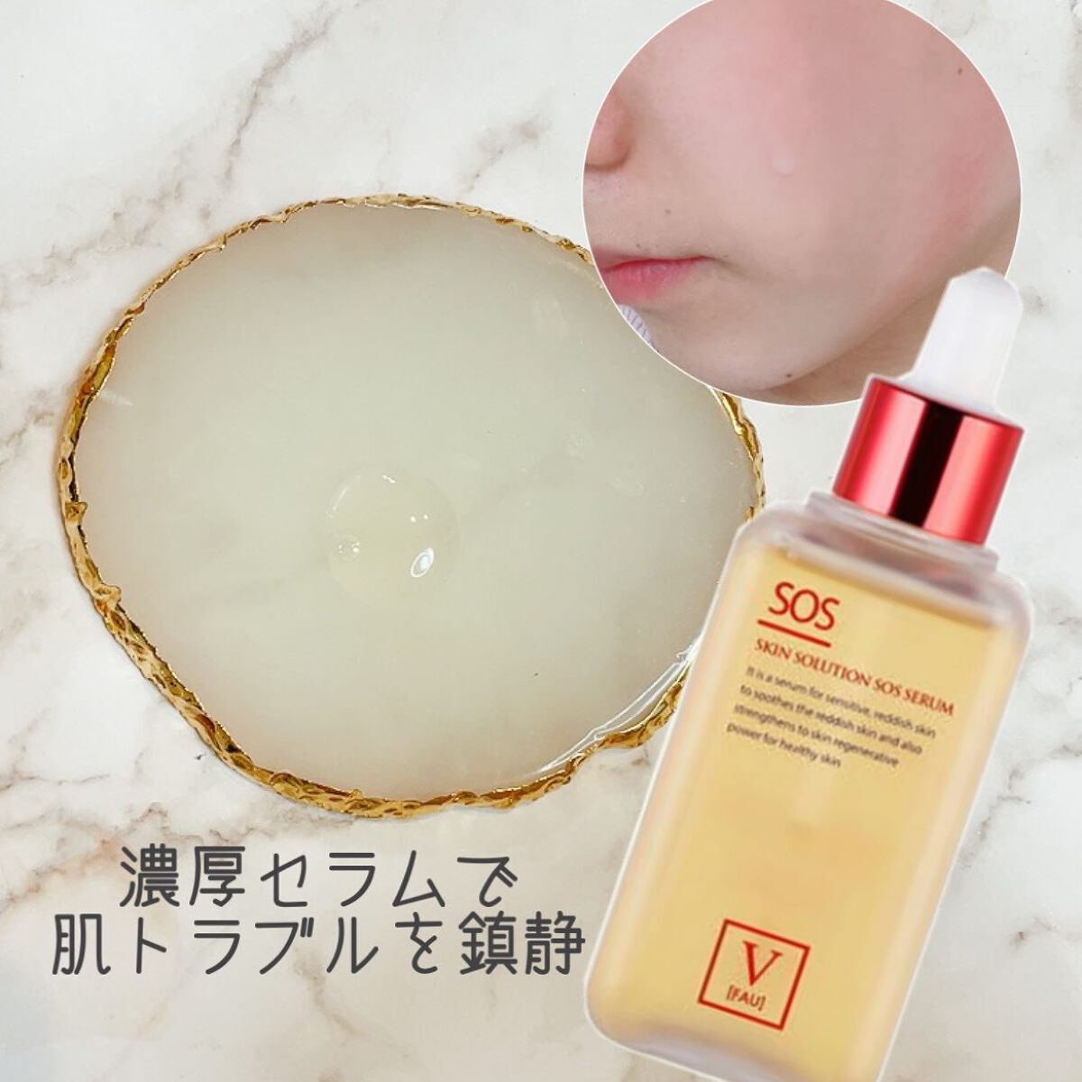 スキンソリューションSOSセラム100ml/FAU/美容液を使ったクチコミ（1枚目）