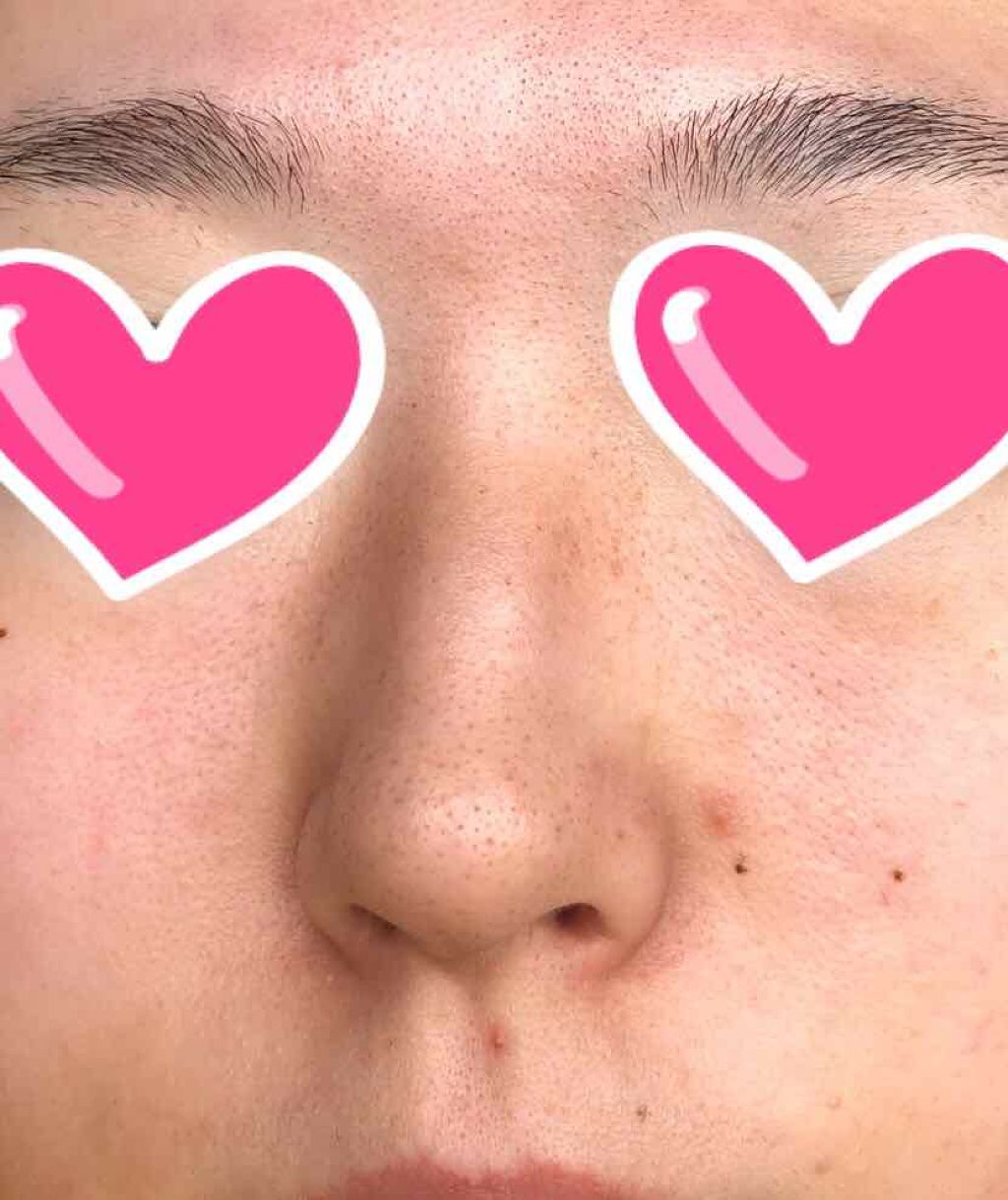 ロゼットゴマージュ/ロゼット/ピーリングを使ったクチコミ（2枚目）