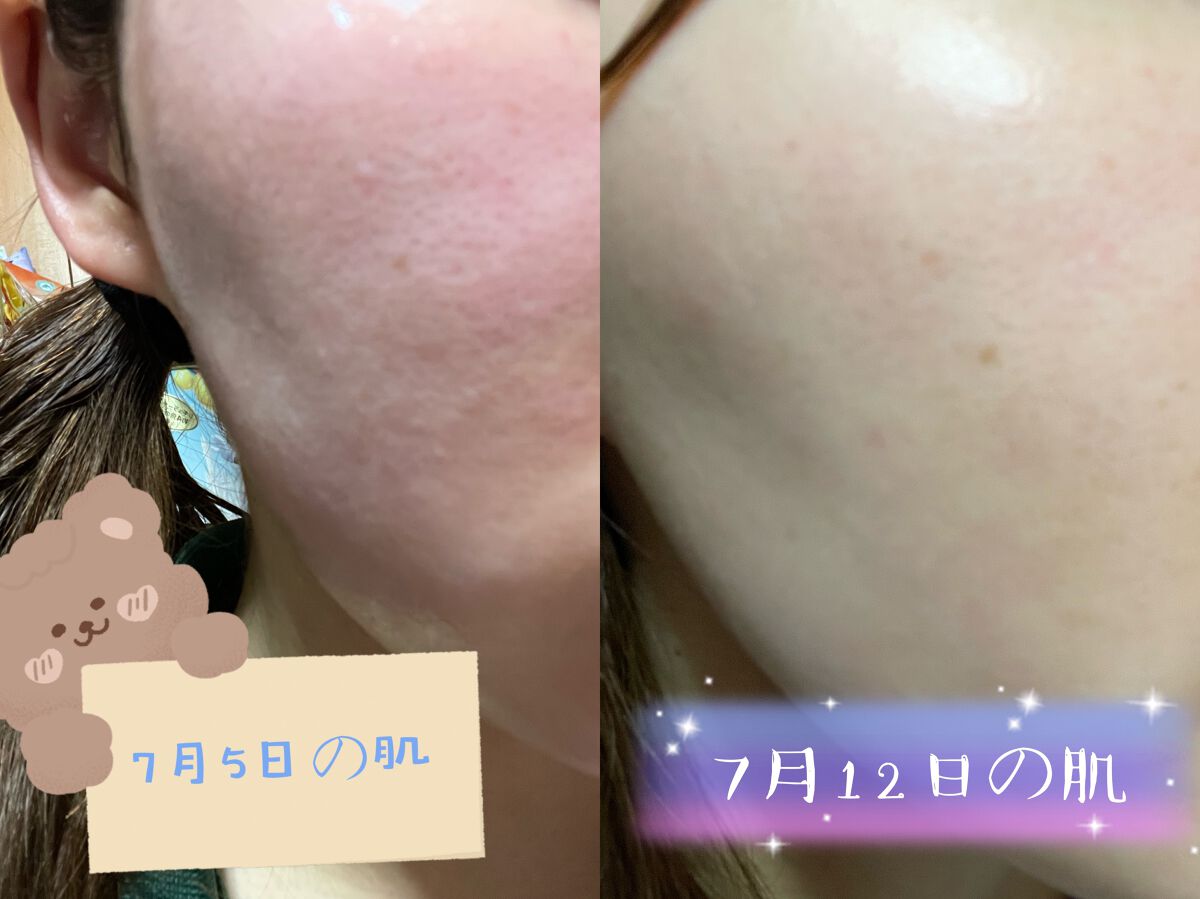 アミノ酸浸透水/Mマークシリーズ/化粧水を使ったクチコミ（2枚目）