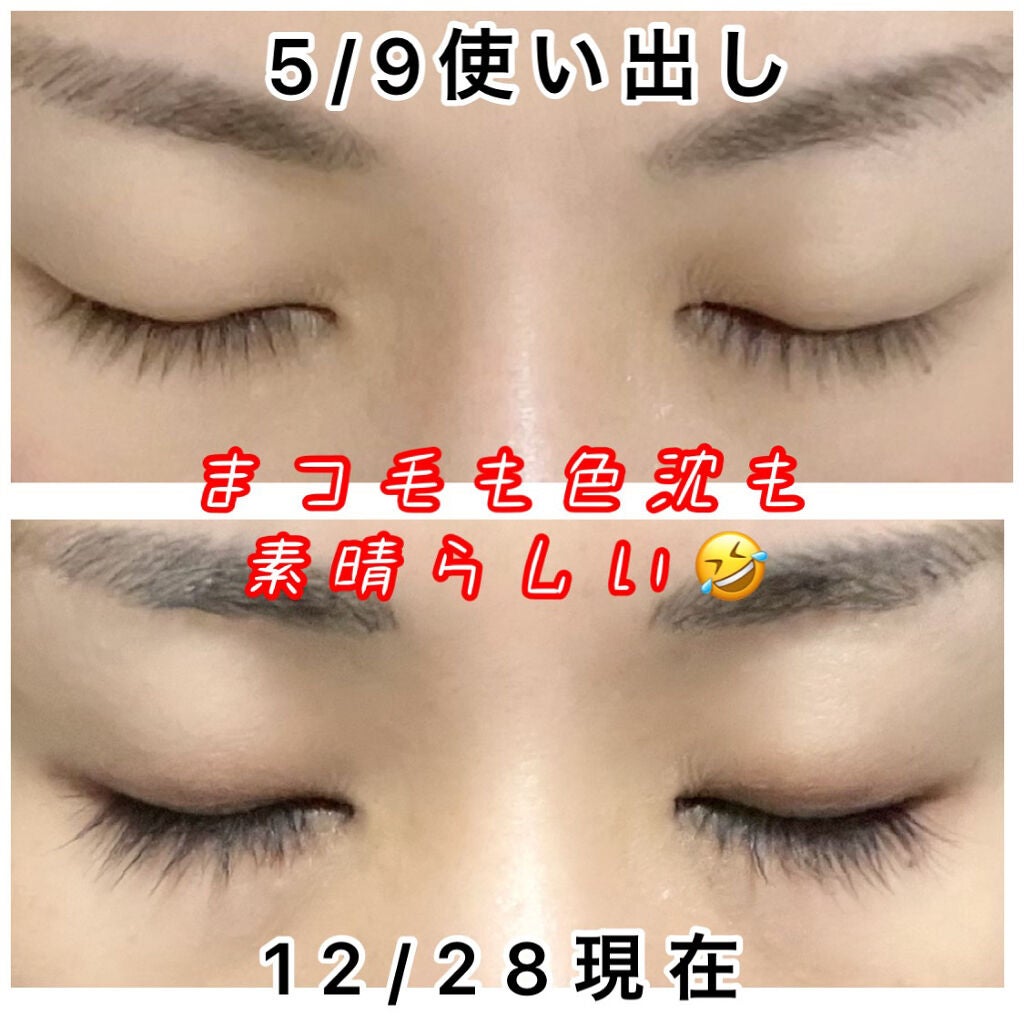 EMAKED(エマーキット)/水橋保寿堂製薬/まつげ美容液を使ったクチコミ(2枚目)