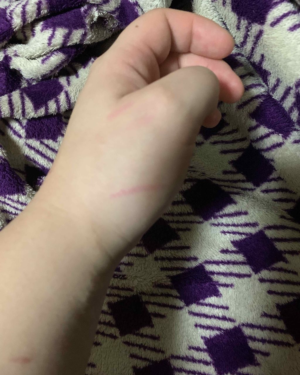 フラワーティントリップN オイルイン/Kailijumei/リップティントを使ったクチコミ(3枚目)