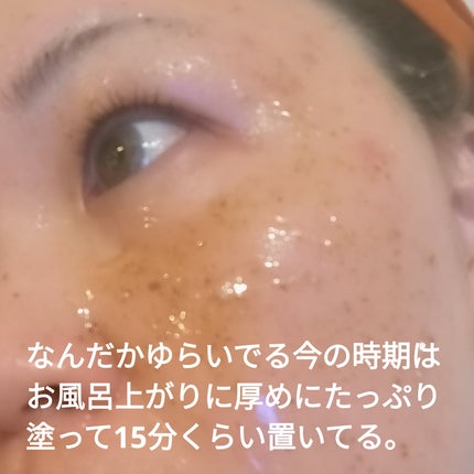 リアルシカペストパック/ビューランチ/洗い流すパック・マスクを使ったクチコミ(3枚目)