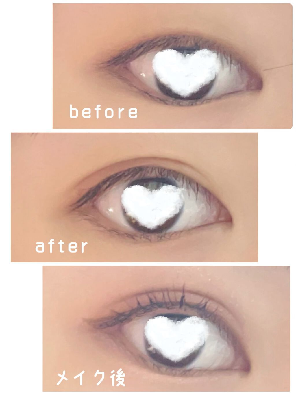 のびーるアイテープ(絆創膏タイプ、レギュラー)/DAISO/二重まぶた用アイテムを使ったクチコミ(3枚目)