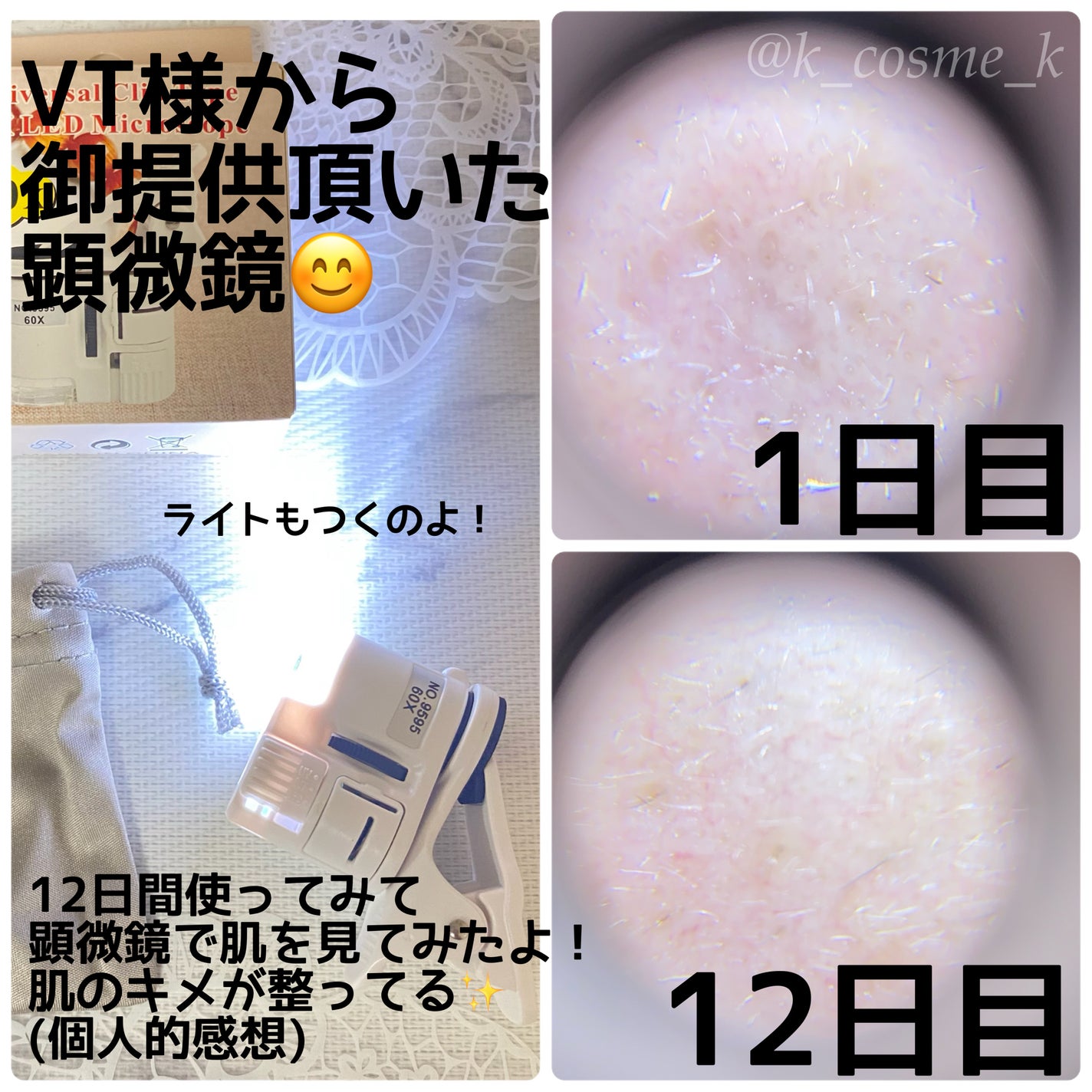 リードルショット300/VT/美容液を使ったクチコミ(4枚目)