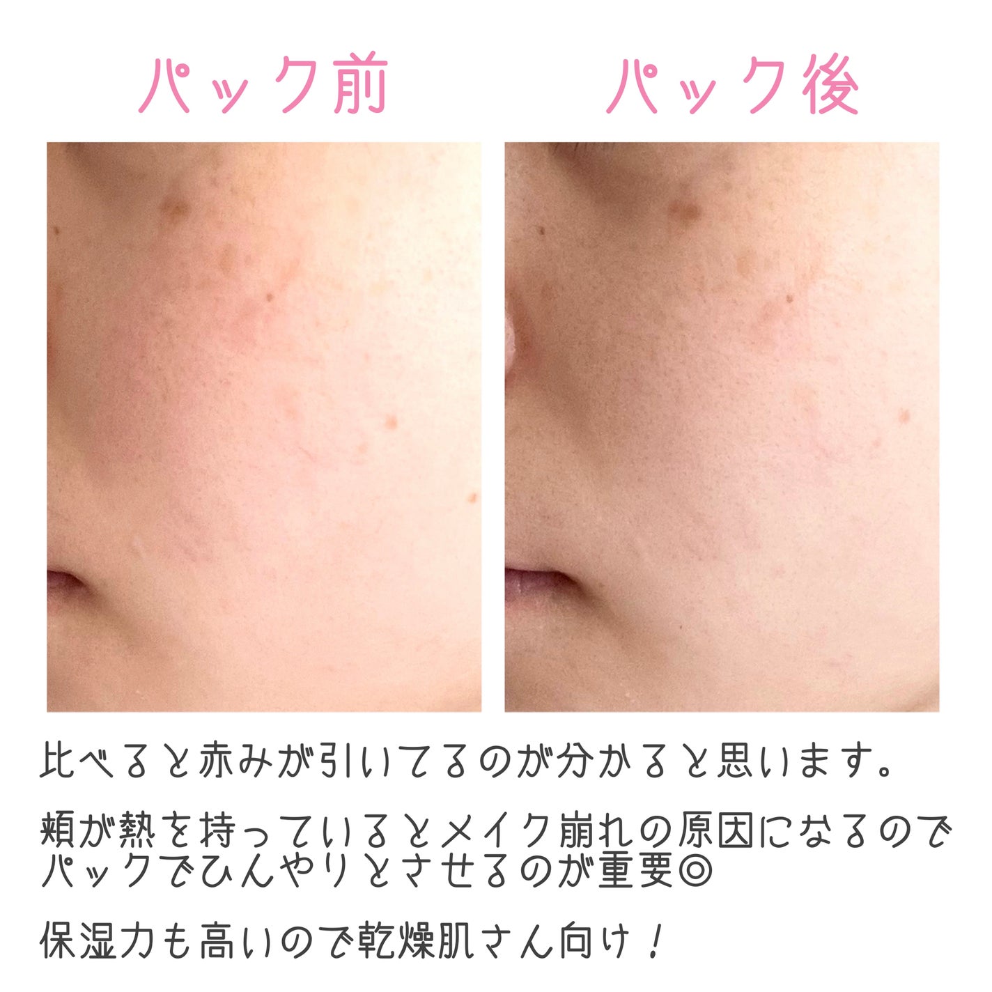 ウォンジョンヨ モイストアップレディスキンパック DM N/Wonjungyo/シートマスク・パックを使ったクチコミ(4枚目)