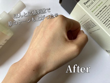フェイシャルマイルドピーリング/primera/ピーリングを使ったクチコミ(6枚目)
