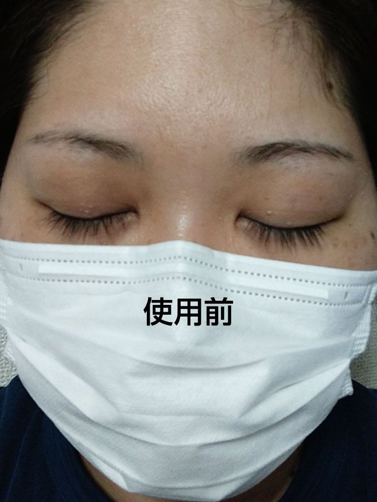 TWOOL ダブルアイリッドグルー/SHOBIDO/二重まぶた用アイテムを使ったクチコミ(8枚目)