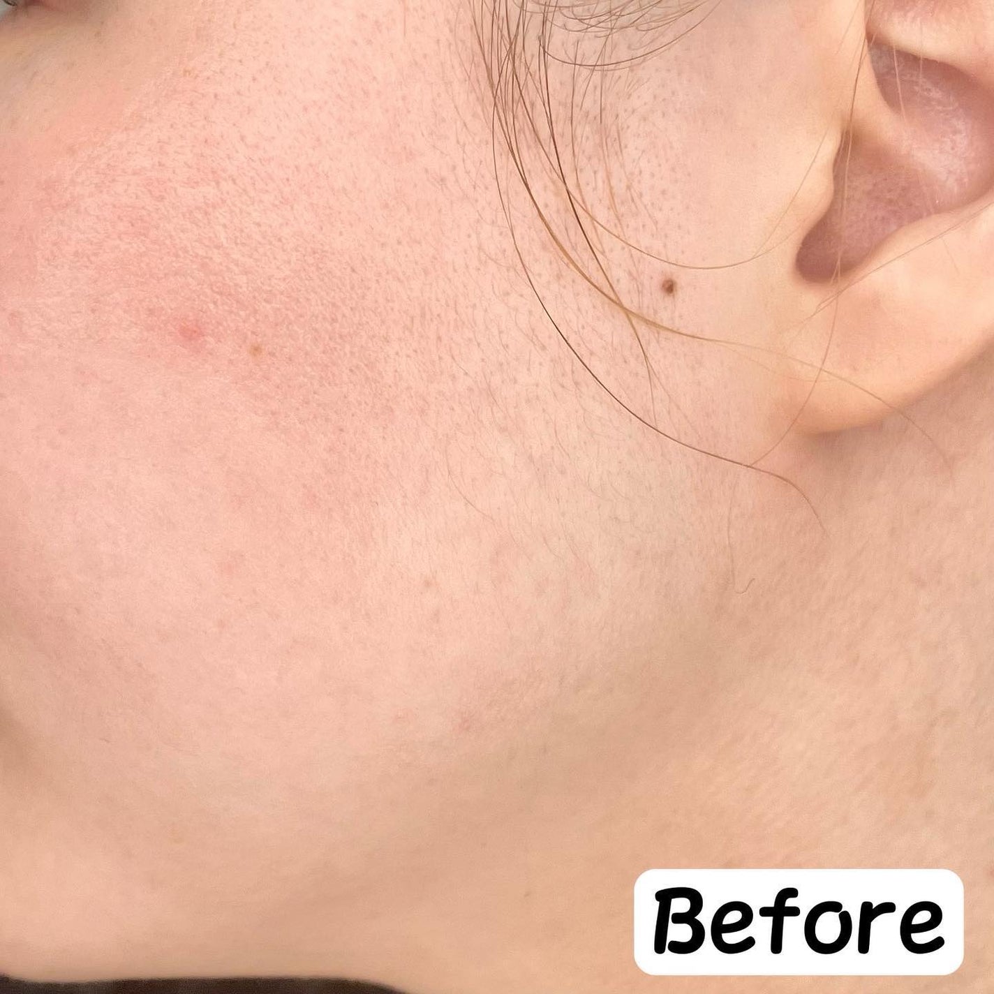 バックミートーンアップサンクッション/rom&nd/日焼け止めローションを使ったクチコミ(4枚目)