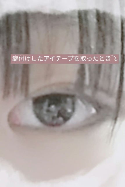 あ い り on LIPS 「こんばんは👋 あ い り です!!私の二重成長記録について1つ..」(5枚目)