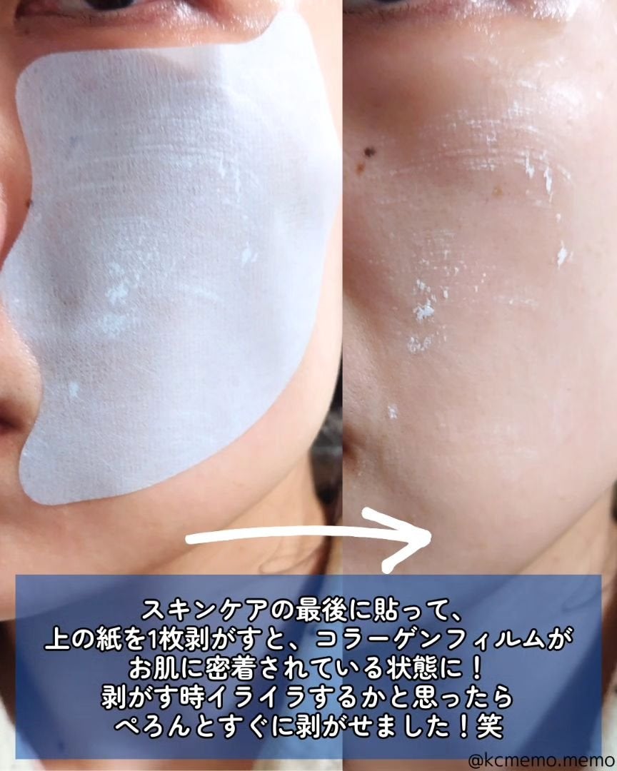 ドクタージー ブラックスネイル コラーゲンミスト/Dr.G/ミスト状化粧水を使ったクチコミ(5枚目)