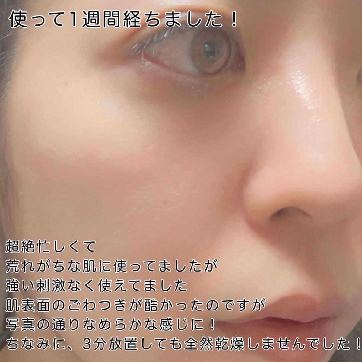 タカミスキンピール/タカミ/ブースター・導入液を使ったクチコミ(4枚目)