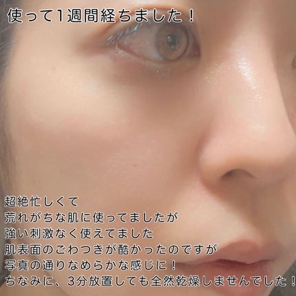 タカミスキンピール/タカミ/ブースター・導入液を使ったクチコミ(4枚目)