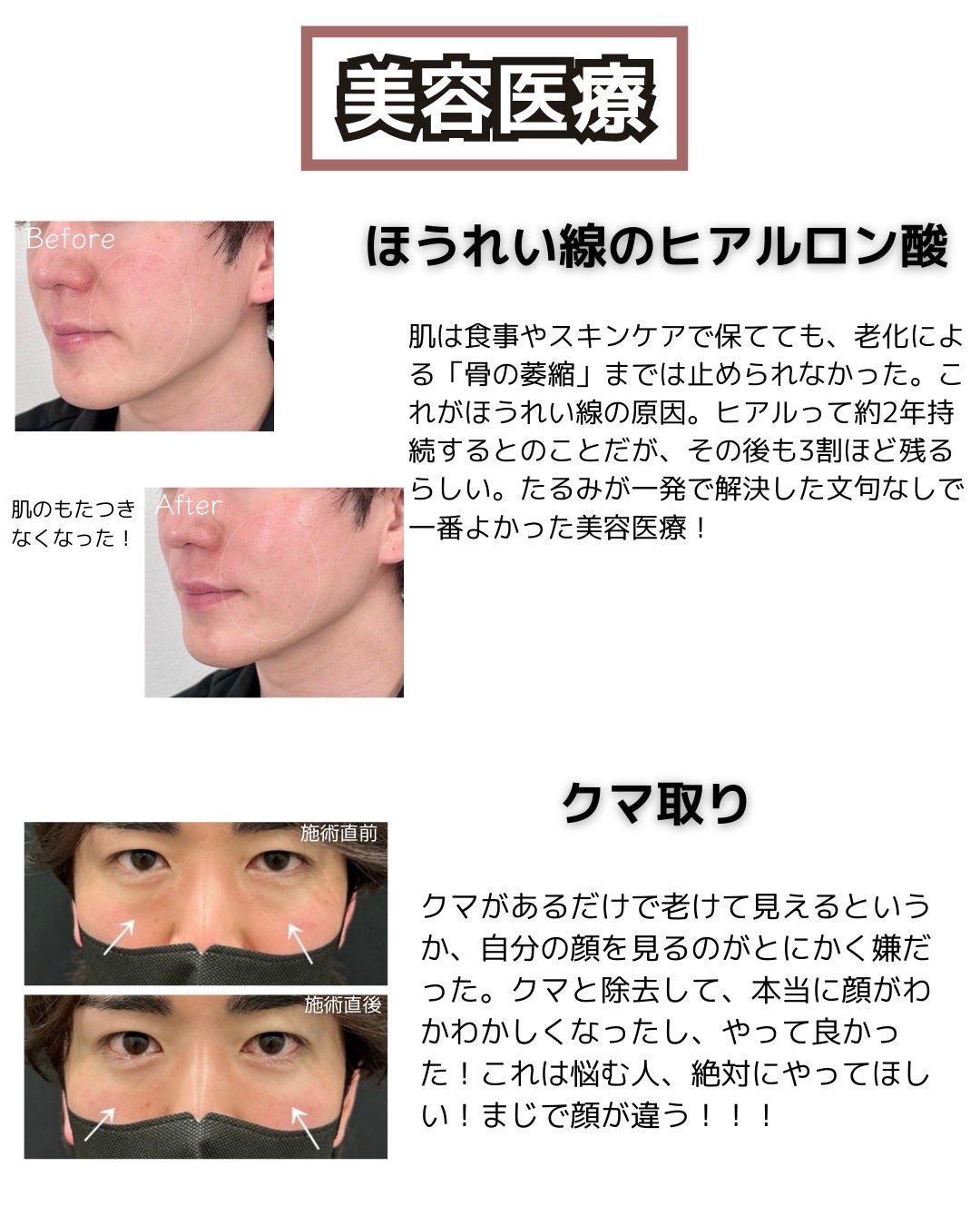 コタトリート プレミーク ホームケア モイスチャー/コタ/洗い流すヘアトリートメントを使ったクチコミ(5枚目)