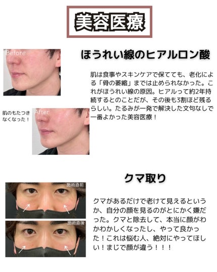 コタトリート プレミーク ホームケア モイスチャー/コタ/洗い流すヘアトリートメントを使ったクチコミ(5枚目)