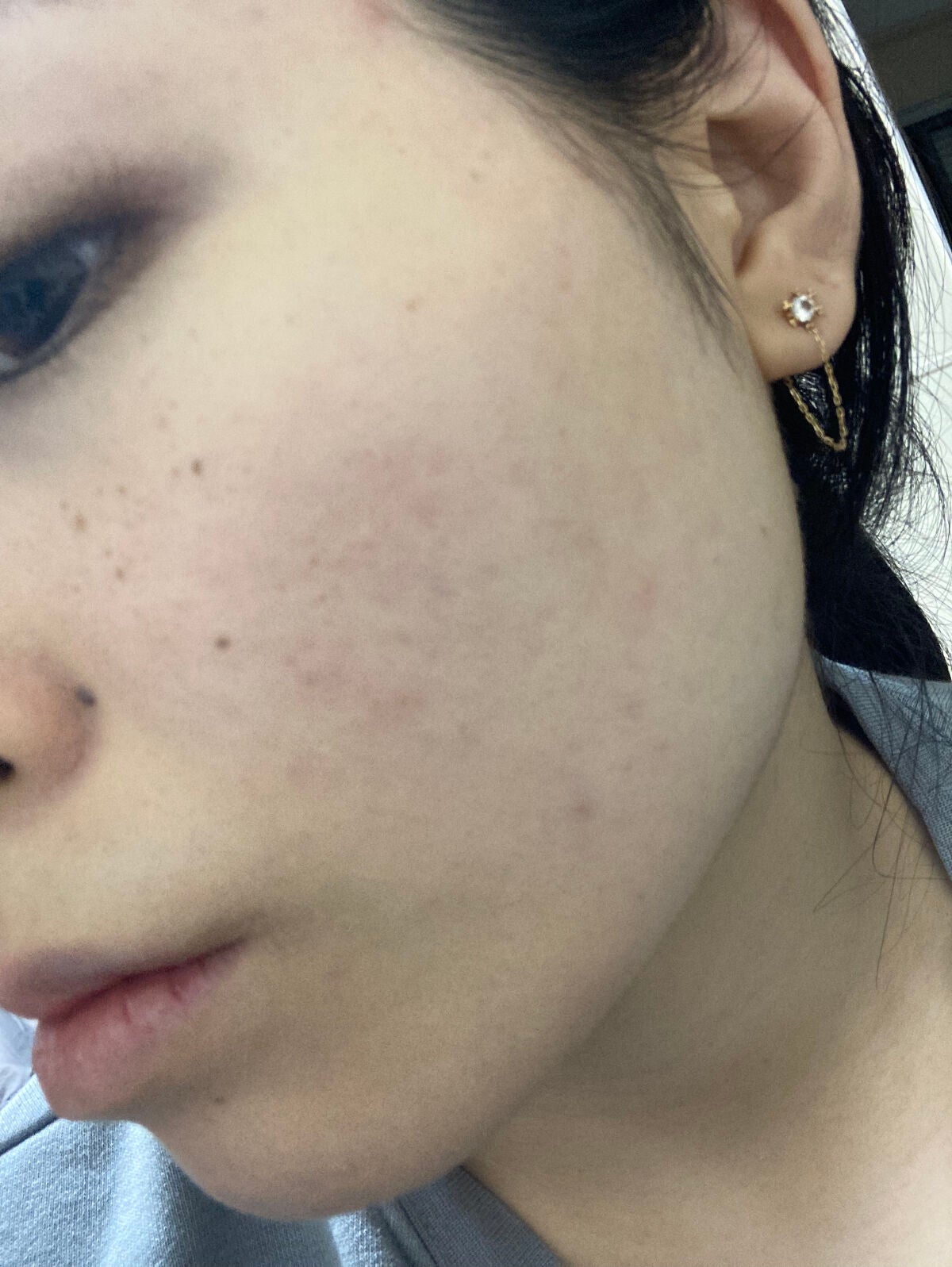 イプノス シーバムクリア リペアクリーム/ACSEINE/フェイスクリームを使ったクチコミ(4枚目)