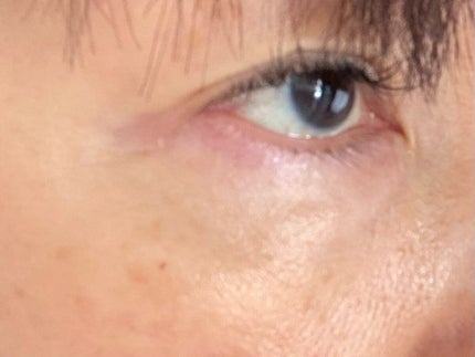 ホワイトニングパーフェクトエッセンス/MEOTO/美容液を使ったクチコミ(5枚目)