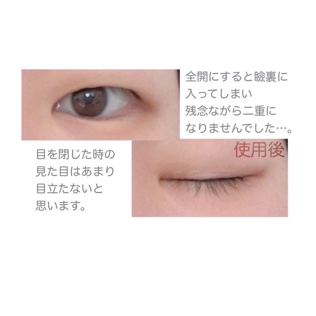 ハイブリッドフィルム/アイトーク/二重まぶた用アイテムを使ったクチコミ(10枚目)