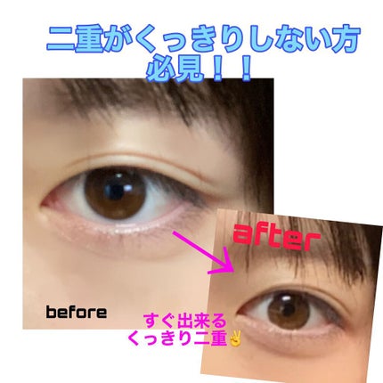 絆創膏/DAISO/その他を使ったクチコミ(1枚目)