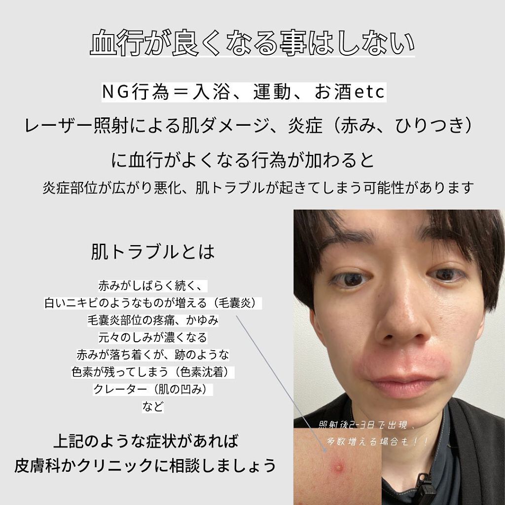 を使ったクチコミ（2枚目）