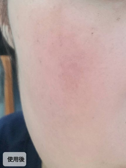 エアリーフィットサンスティック/KAHI/日焼け止めスティックを使ったクチコミ(6枚目)