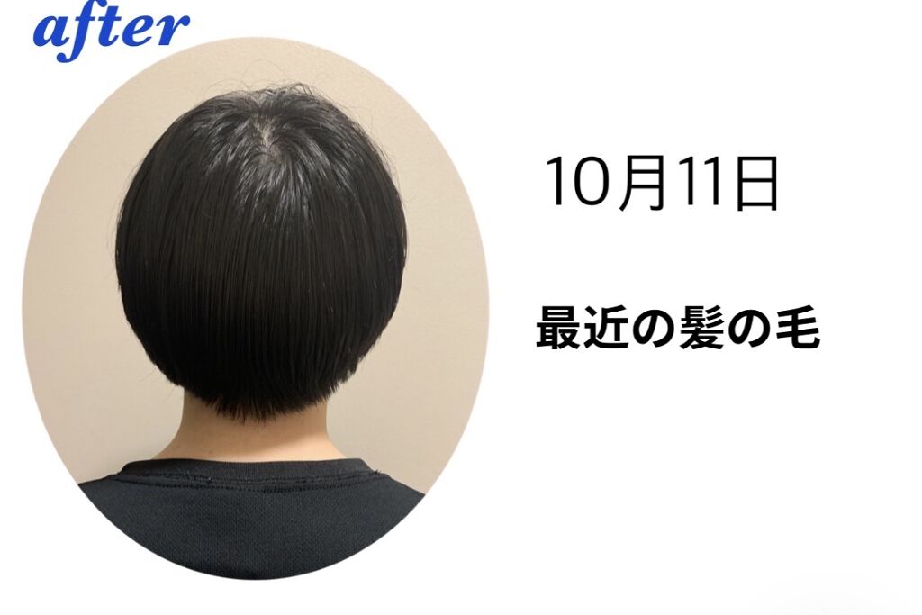 DHC 亜鉛/DHC/健康サプリメントを使ったクチコミ（3枚目）