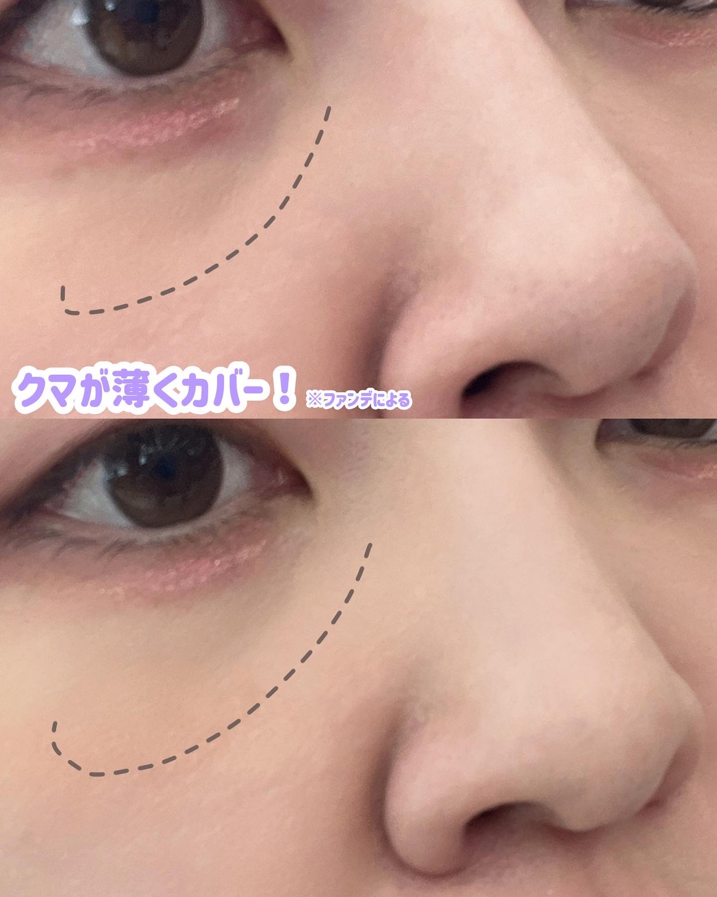 アイレノール クマクリーム/IRENOL/アイケア・アイクリームを使ったクチコミ(3枚目)