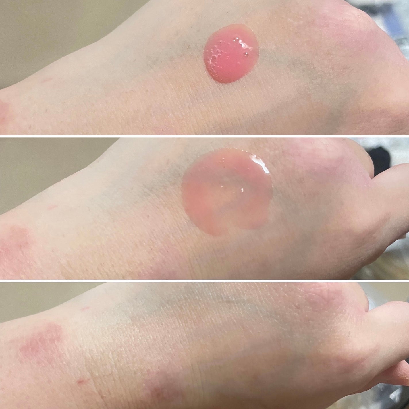 PDRNピンクアンプル PDRN 10,000ppm配合/MEDICUBE/美容液を使ったクチコミ(3枚目)