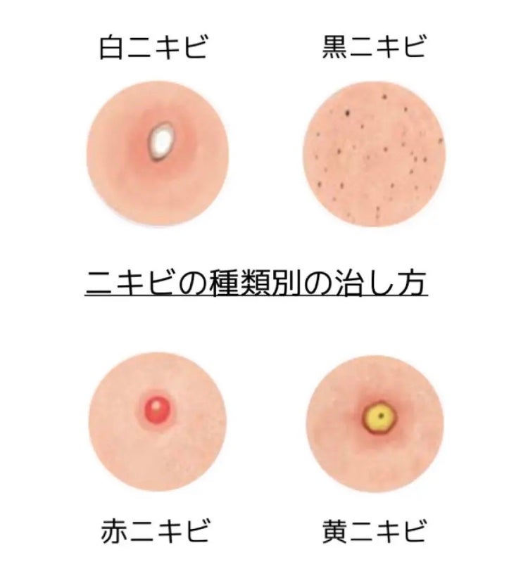 ザ・タイムR アクア/IPSA/化粧水を使ったクチコミ(1枚目)