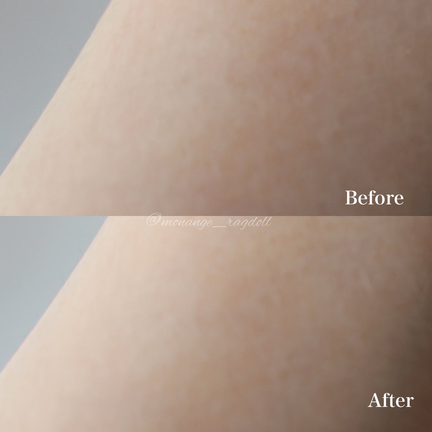 泡の集中パック/ドモホルンリンクル/洗い流すパック・マスクを使ったクチコミ(6枚目)