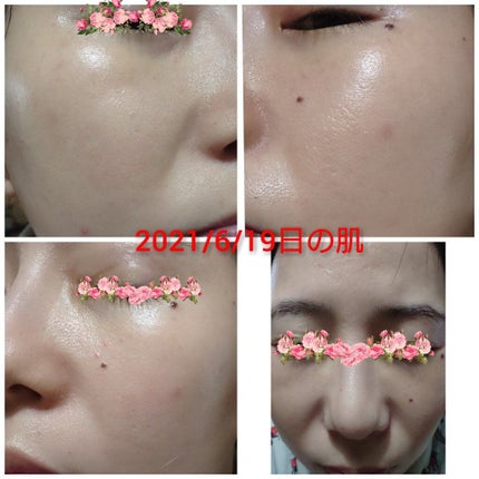 CICA デイリースージングマスク/VT/シートマスク・パックを使ったクチコミ(4枚目)