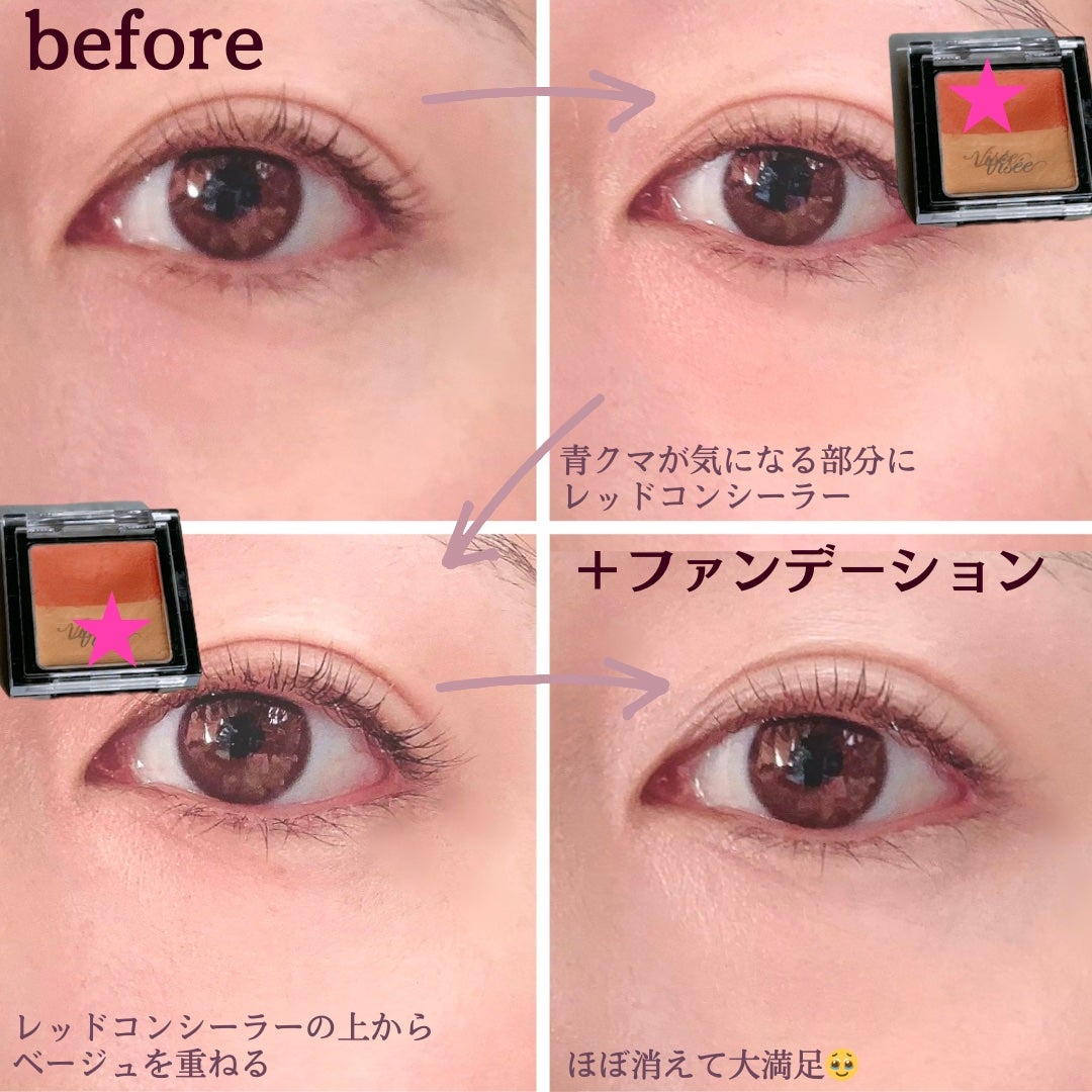リシェ レッドトリック アイコンシーラー/Visée/パレットコンシーラーを使ったクチコミ(3枚目)