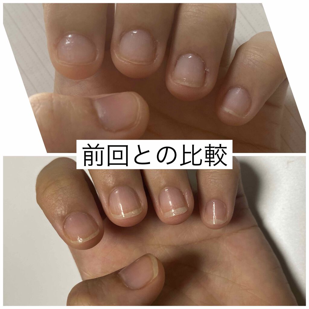 ネイルトリートメントジェルD/DAISO/ネイルオイル・トリートメントを使ったクチコミ（3枚目）
