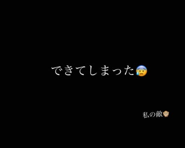 休みの日にできてしまった、、、
卒業式が終わってこの時期は友達と遊ぶことが多くて...
 いっぱい食べたり、夜更かししてしまってニキビができてしまった😫


ーーーーー✖️✖️✖️ーーーーーーーーーーーー

ニキビができたらすること！！
・肌のケア
　　①特に10代は皮脂が多いため毛穴に詰まりやすいので肌をきれいにする
　　②乾燥肌が原因にもなるから保湿をしかりする
          
   ・注意すること
　　①ニキビを触らない潰さない
　　②顔を洗う時に擦らない
　　
なかなか治りにくいニキビ、ニキビ跡にならないか不安になったら皮膚科に行くのもいいと思います👍

塗る薬とか飲み薬もらえるからニキビ頑張って治そ！！！ 
#ニキビスキンケア の画像 その0