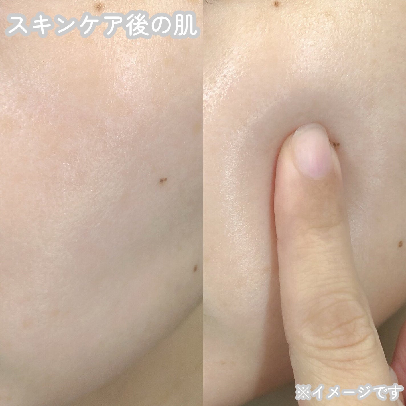 シカレチA エッセンス0.1/VT/美容液を使ったクチコミ(5枚目)