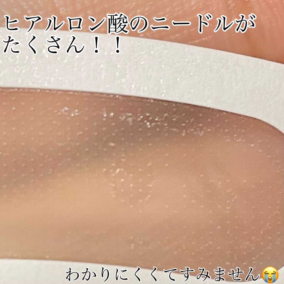 W+ マイクロ ニードル パッチ/SNP/アイケア・アイクリームを使ったクチコミ(2枚目)