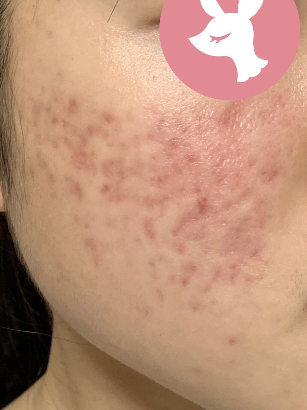 化粧水・敏感肌用・高保湿タイプ/無印良品/化粧水を使ったクチコミ（2枚目）